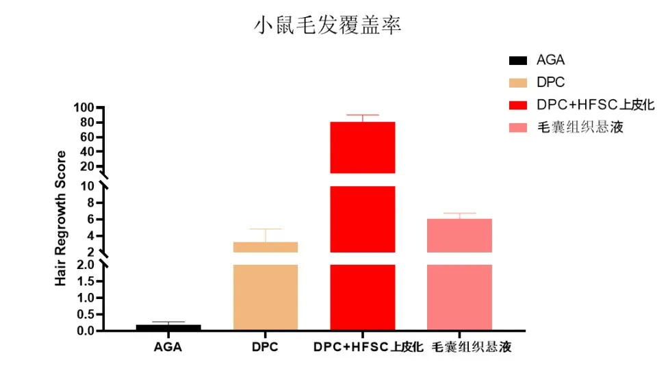 毛乳头细胞与上皮化细胞联合方案的毛发覆盖率对比